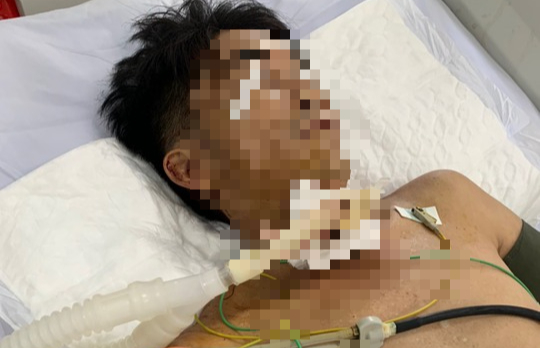 Người đàn ông tự dùng dao cứa cổ, đâm vào bụng