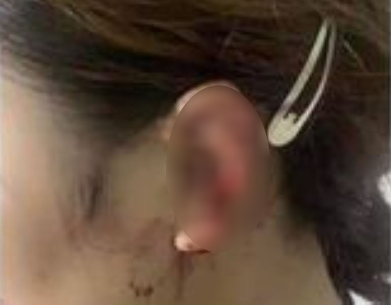 X&ocirc;n xao clip người phụ nữ tung cước đạp vỡ k&iacute;nh &ocirc;t&ocirc;, cắn đứt tai c&ocirc; g&aacute;i - Ảnh 2.