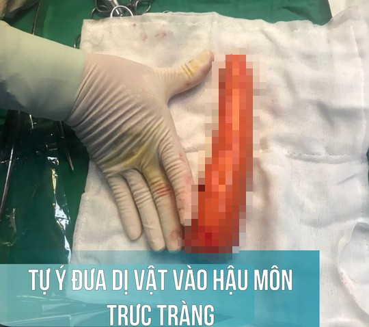 Thử "cảm giác lạ", nam thanh niên tự nhét củ cà rốt 20 cm vào hậu môn