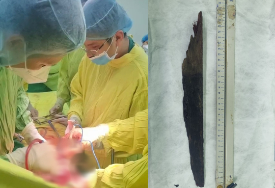 Thiếu niên 17 tuổi gặp tai nạn thương tâm vì tránh con chó lao ra đường