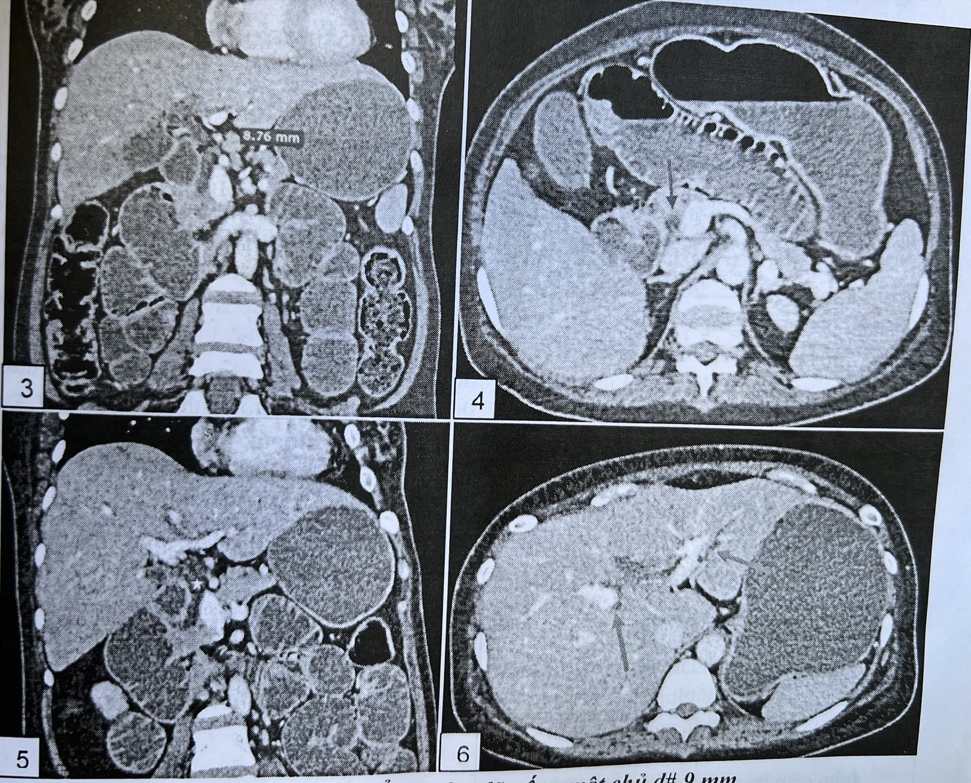 Ca bệnh hiếm gặp ở TP HCM