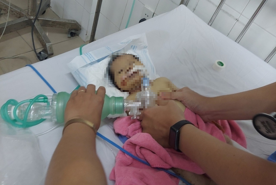 Sức khỏe cháu bé bị bỏ rơi giữa rừng ở Quảng Nam chuyển biến xấu