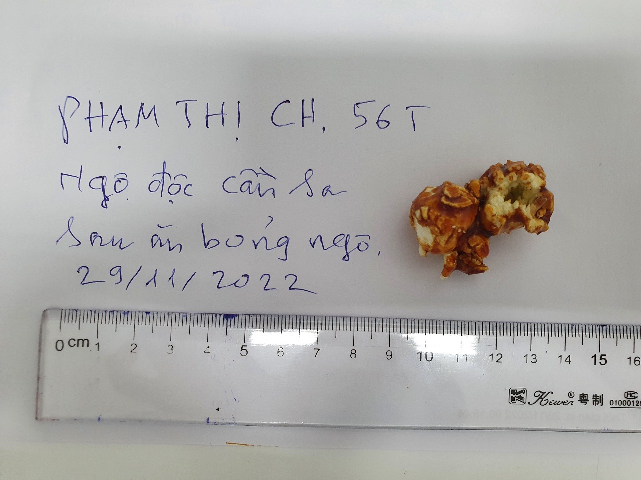 Ăn bỏng ng&ocirc; con mua tr&ecirc;n mạng, người phụ nữ ngộ độc cần sa nhập viện cấp cứu - Ảnh 1.