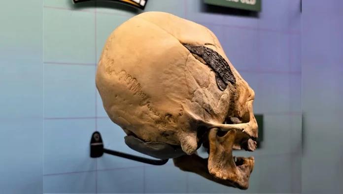 Bí ẩn hộp sọ "người ngoài hành tinh" ngàn năm gắn kim loại