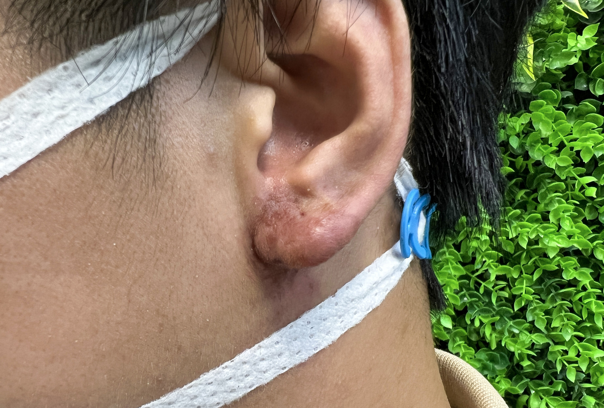 Tự tạo h&igrave;nh tai Phật, bị trở th&agrave;nh tai hư - Ảnh 1.