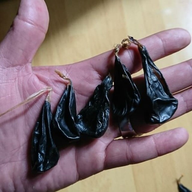 Cho uống mật khỉ, cháu bé 9 ngày tuổi nguy kịch