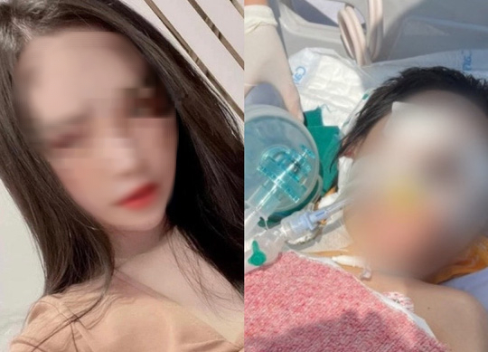Vụ cô gái tử vong sau nâng mũi: Tạm đình chỉ công tác 1 bác sĩ Bệnh viện Ung bướu Hà Nội