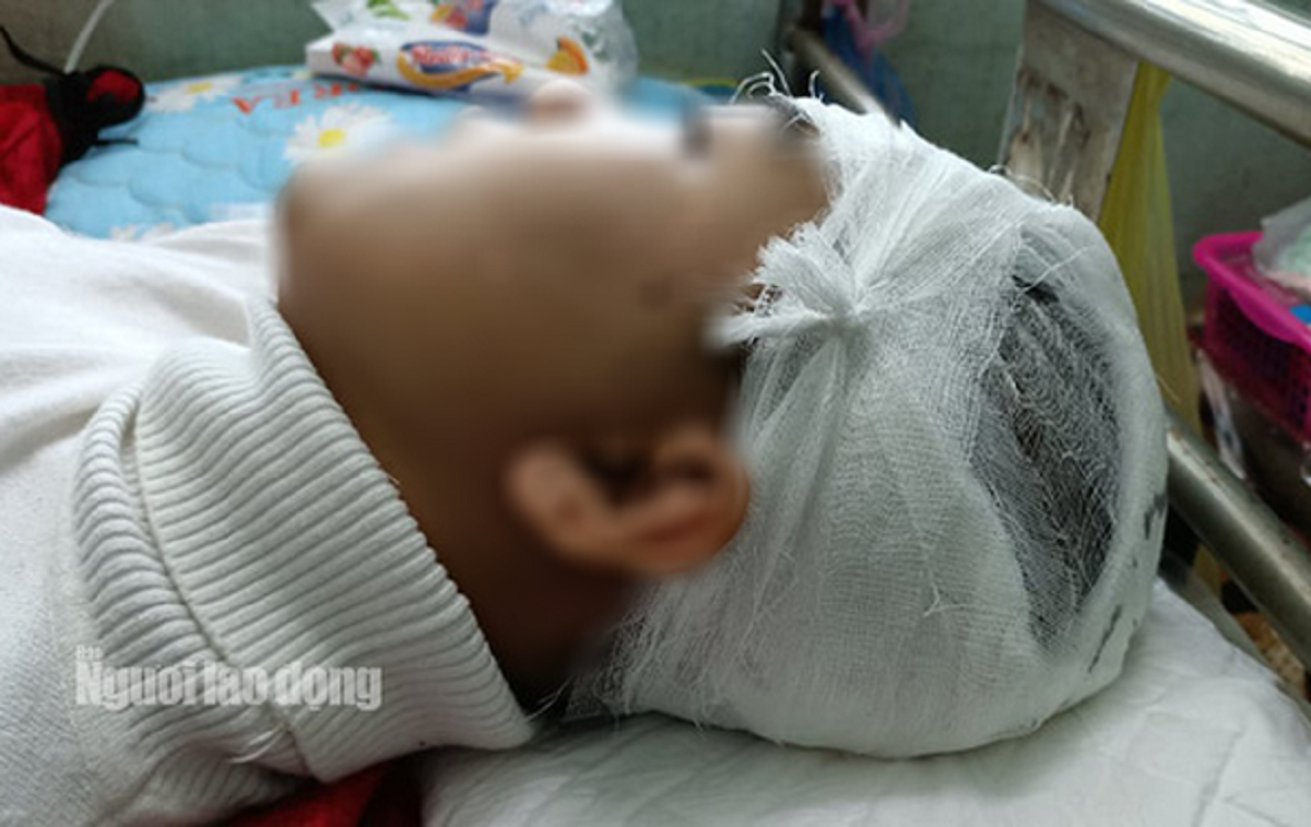 3 nam sinh đ&aacute;nh bạn c&ugrave;ng trường vỡ sọ n&atilde;o - Ảnh 2.