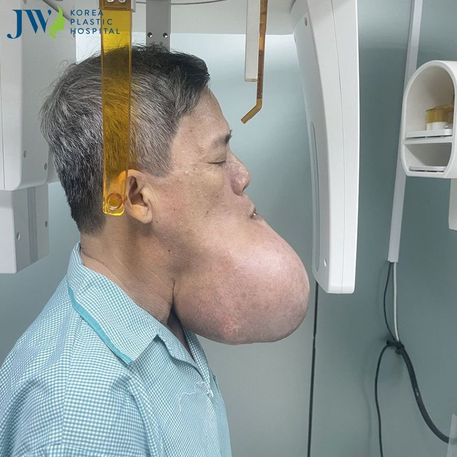 Chạy đua cứu người đàn ông 10 năm mang khối u quái khổng lồ trên mặt