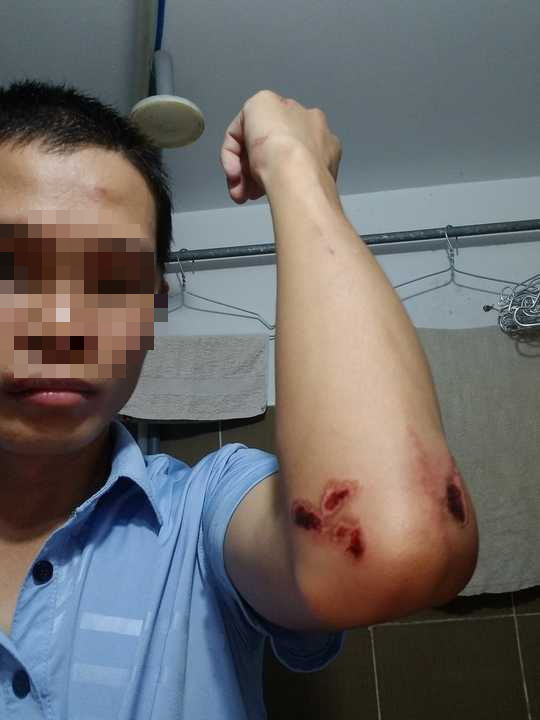 CLIP: T&agrave;i xế xe c&ocirc;ng nghệ bị tấn c&ocirc;ng d&atilde; man gần Bến xe Miền T&acirc;y - Ảnh 3.