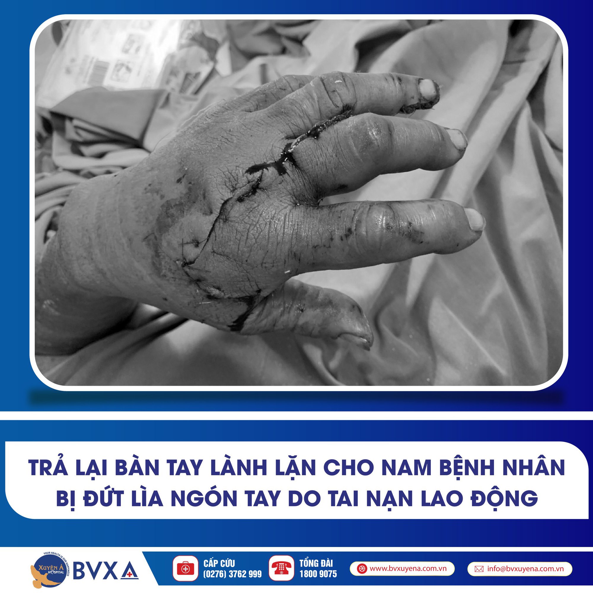 Người đàn ông đến bệnh viện với 2 ngón tay đứt lìa được ướp đá