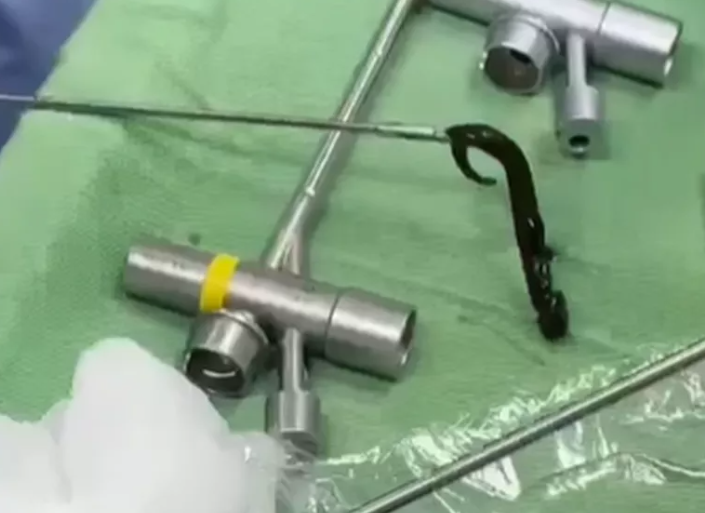 Con vắt rừng d&agrave;i 8 cm sống nhiều ng&agrave;y trong đường thở của b&eacute; 6 tuổi - Ảnh 1.
