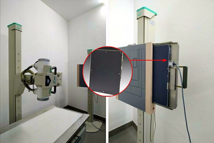 H&agrave;ng loạt trung t&acirc;m y tế ở B&igrave;nh Dương, TP HCM bị trộm đột nhập th&aacute;o m&aacute;y X-quang - Ảnh 2.