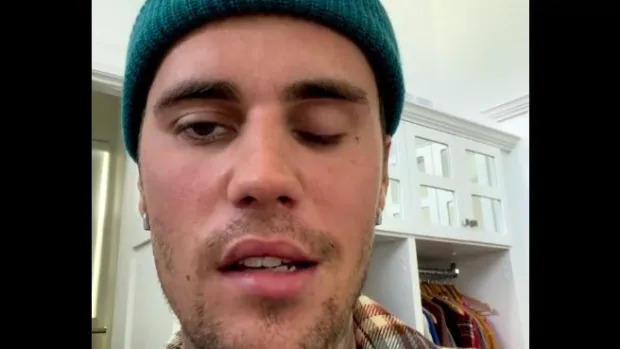 Ca sĩ Justin Bieber bị liệt nửa mặt vì virus tấn công