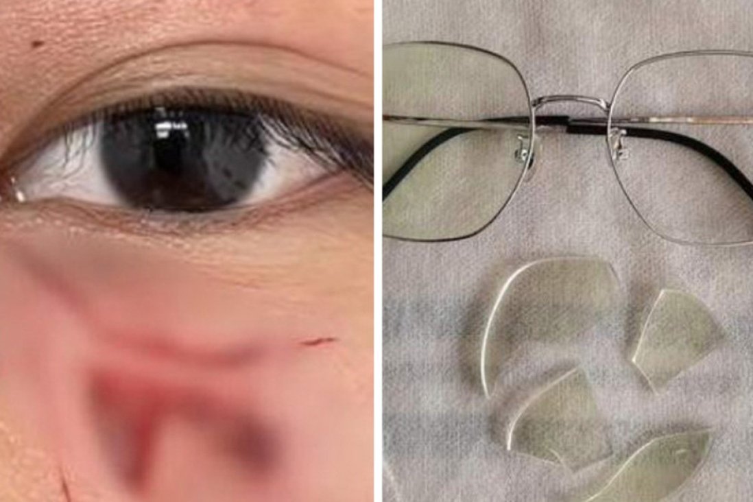 Đấm học sinh khâu 16 mũi, thầy giáo ở Trung Quốc bị sa thải