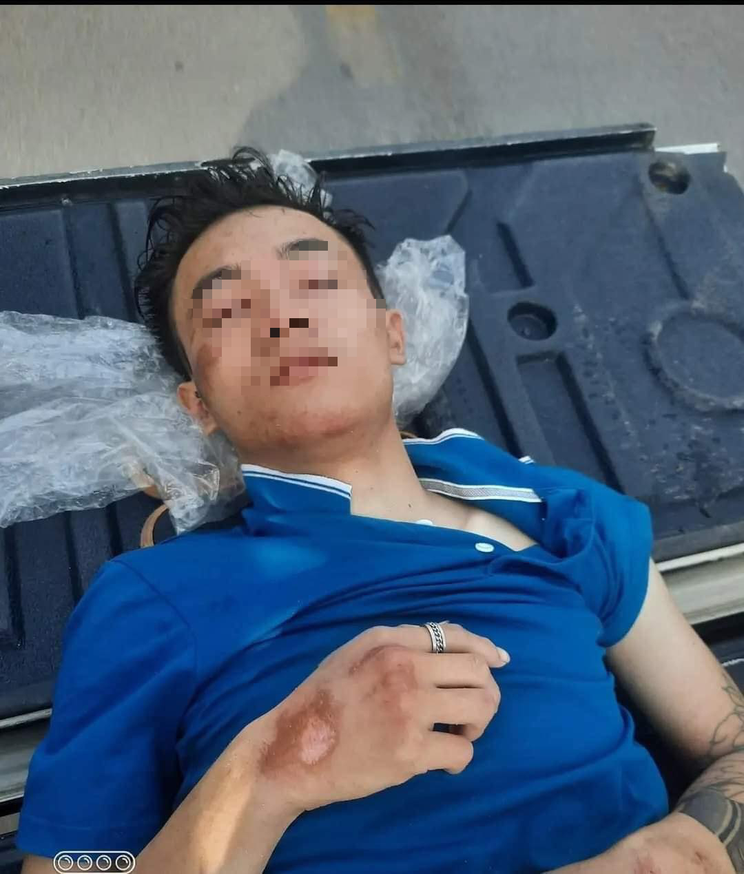 Nam thanh niên được phát hiện trong tình trạng dập não ở nghĩa trang
