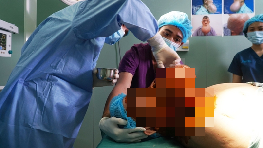 6 giờ nghẹt thở loại bỏ "quả bom sắp nổ" trên mặt người đàn ông