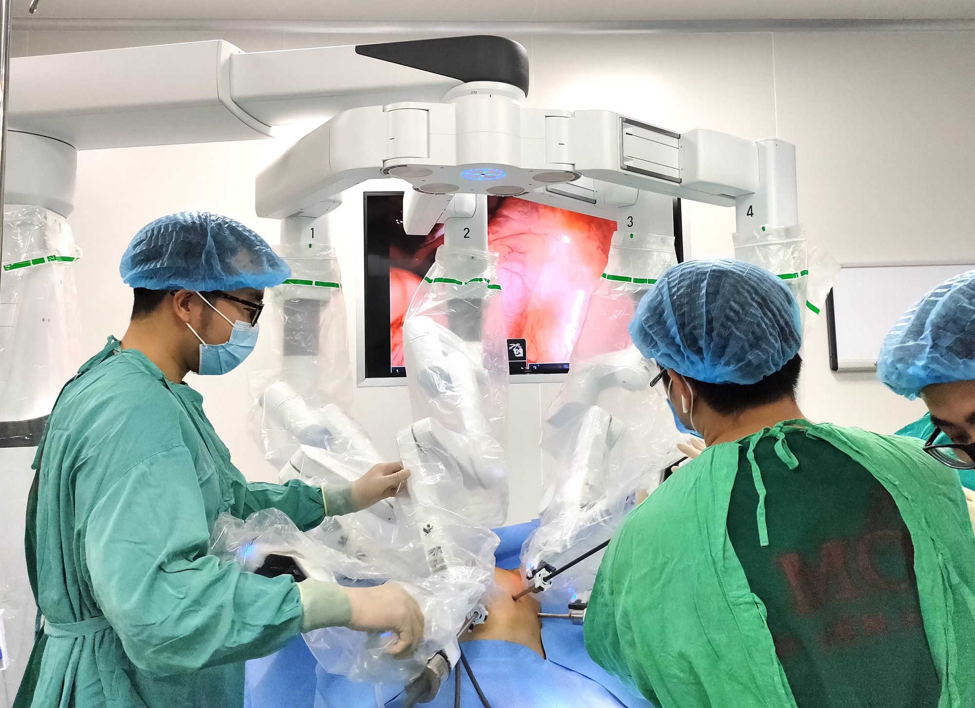 Bệnh viện chờ gỡ vướng "máy mượn, máy đặt"