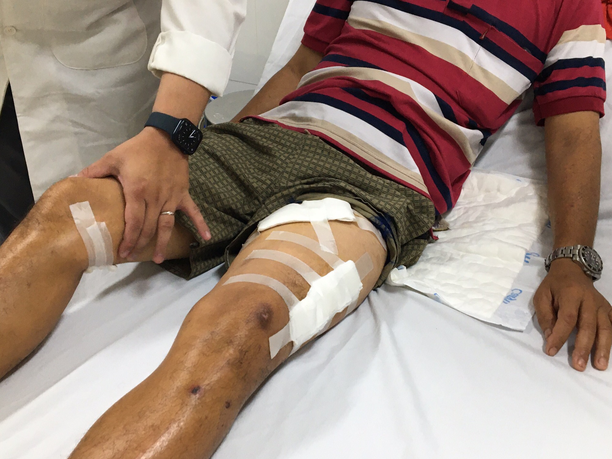 Ba người bị trâu húc nguy kịch - Ảnh 1.
