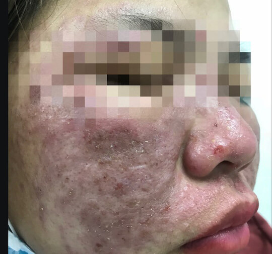 Gia tăng nhu cầu l&agrave;m đẹp, thẩm mỹ theo thần tượng v&agrave; phong thuỷ - Ảnh 3.