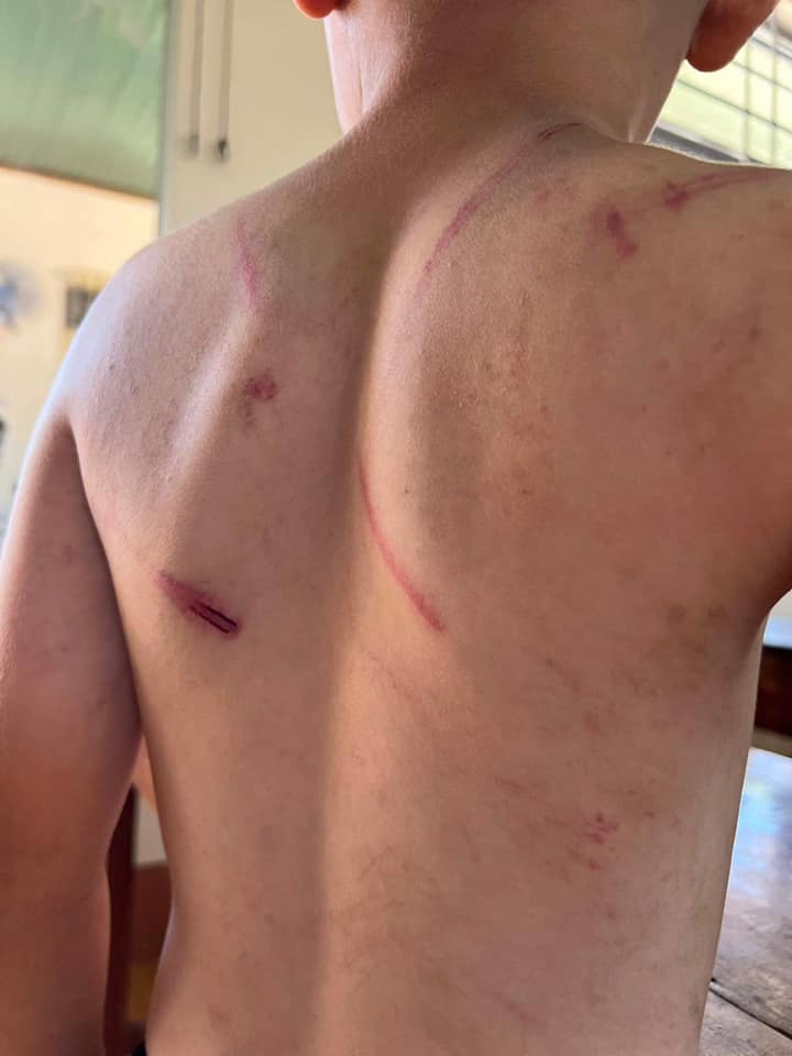 Cháu bé 9 tuổi bị bà và cha đánh đập dã man