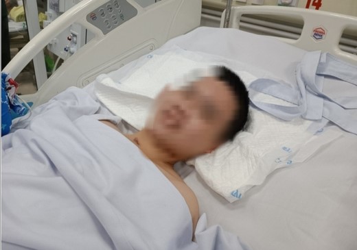 Nữ bệnh nhân 22 tuổi bị viêm não tự miễn nguy kịch