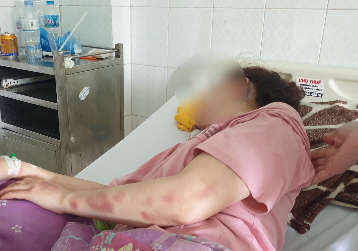 Đ&aacute;nh bạn g&aacute;i nhập viện, một c&aacute;n bộ Cục QLTT Thanh H&oacute;a bị đ&igrave;nh chỉ - Ảnh 1.