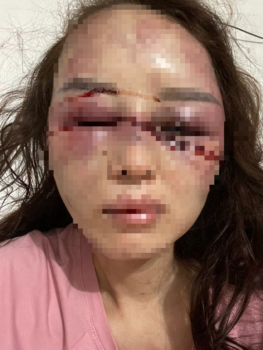 C&ocirc;ng an v&agrave;o cuộc vụ c&aacute;n bộ QLTT đ&aacute;nh bạn g&aacute;i d&atilde; man v&igrave; h&aacute;t song ca với người kh&aacute;c - Ảnh 2.