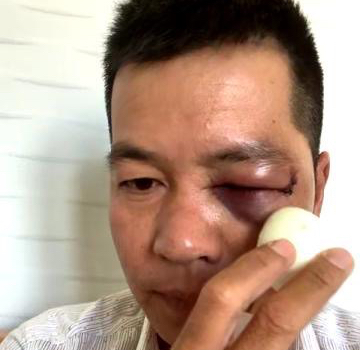 Công an thông tin về vụ đánh người dã man trong tiệm thuốc tây