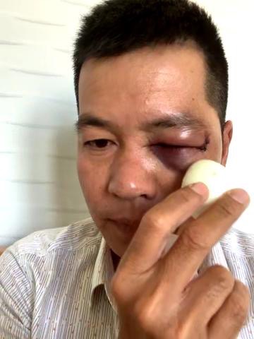 C&ocirc;ng an th&ocirc;ng tin về vụ đ&aacute;nh người d&atilde; man trong tiệm thuốc t&acirc;y - Ảnh 2.