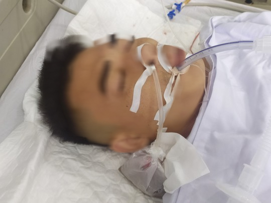 Nh&oacute;m giang hồ đất Cảng nổ s&uacute;ng v&agrave;o nh&agrave; d&acirc;n, bắn 1 người trọng thương - Ảnh 1.