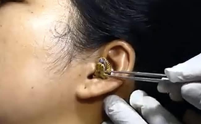 X&ocirc;n xao clip rắn chui v&agrave;o tai người kh&ocirc;ng chịu ra - Ảnh 1.
