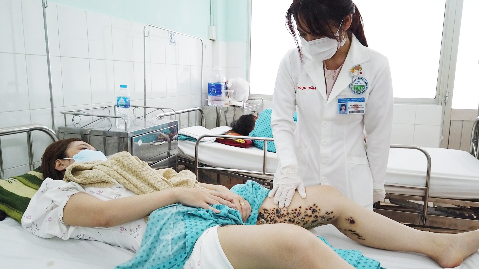 "Tổ ong" phá vùng đùi cô gái sau khi đốt điện tại spa
