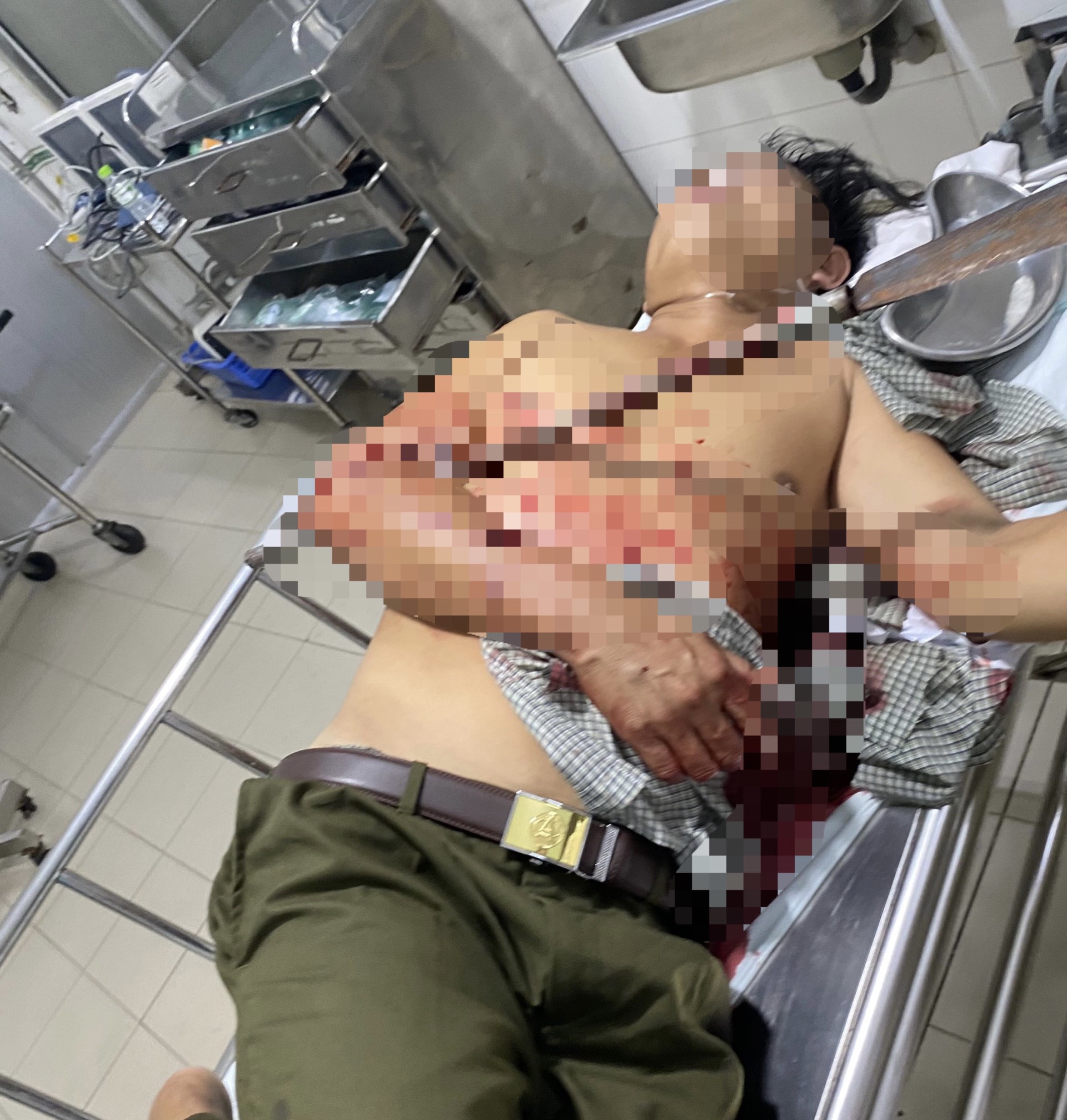 Ngăn chặn hỗn chiến, tổ trưởng dân phòng bị đâm xuyên cánh tay