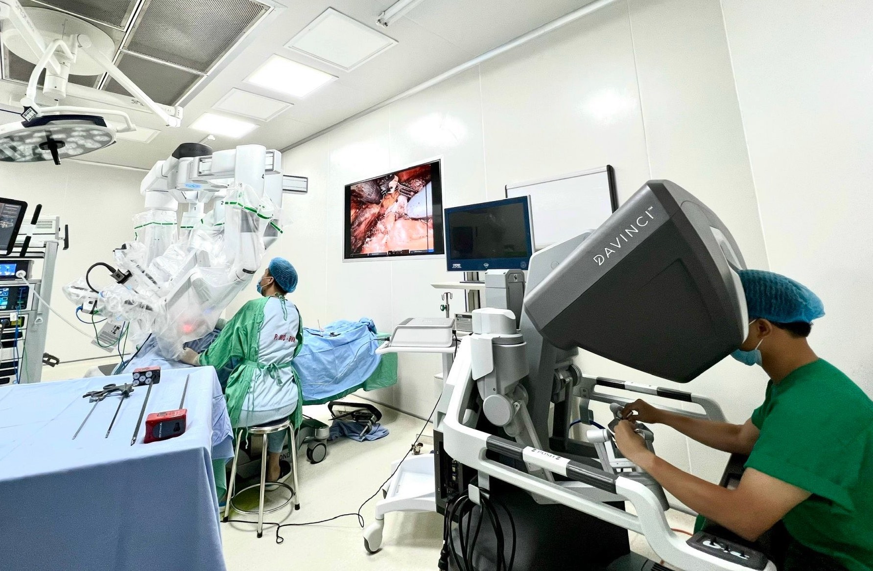 Lần đầu tiên cắt u tuyến giáp qua tiền đình miệng bằng robot - Ảnh 2.