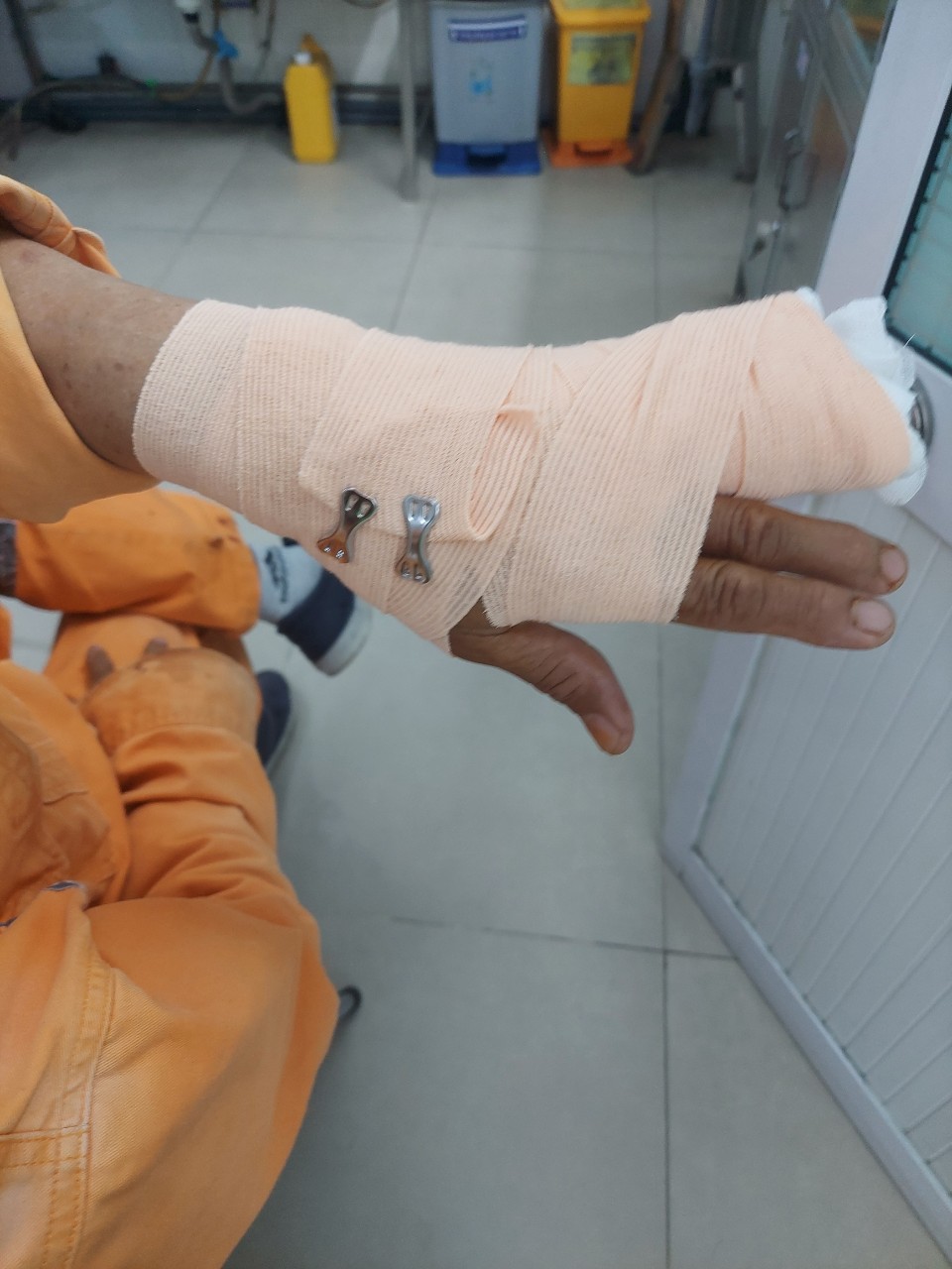 Nh&acirc;n vi&ecirc;n điện lực ở TP HCM bị tấn c&ocirc;ng - Ảnh 1.