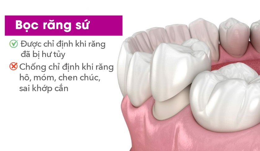3 điều bạn cần biết để l&agrave;m đẹp nụ cười an to&agrave;n - Ảnh 1.