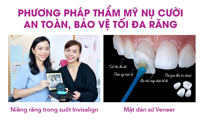 3 điều bạn cần biết để l&agrave;m đẹp nụ cười an to&agrave;n - Ảnh 2.