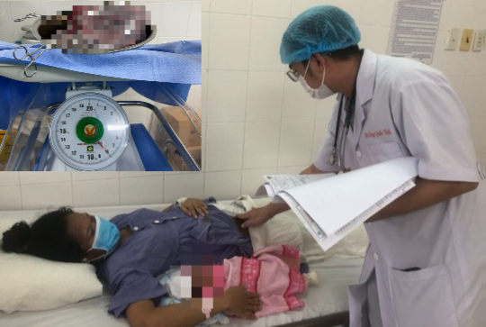 Bé trai may mắn chào đời dù mẹ mang khối u buồng trứng 8kg