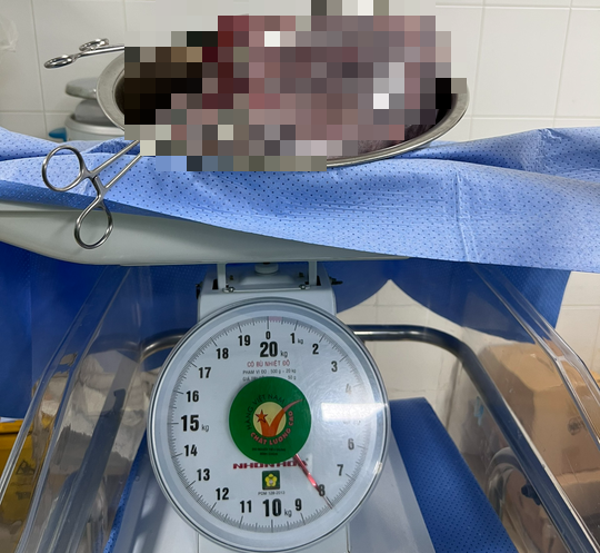 Bé trai may mắn chào đời dù mẹ mang khối u buồng trứng 8kg - Ảnh 2.