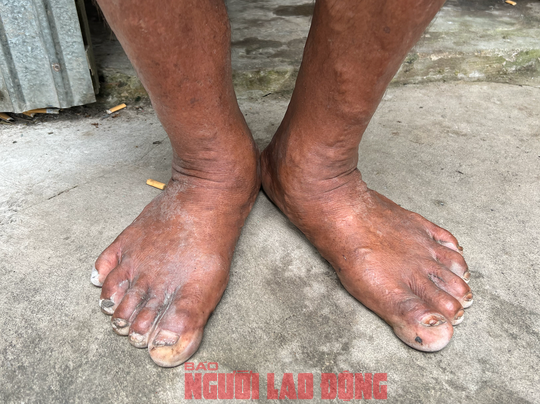 CLIP: Người khổng lồ cao hơn 2,1m ở Cần Thơ b&acirc;y giờ ra sao? - Ảnh 6.