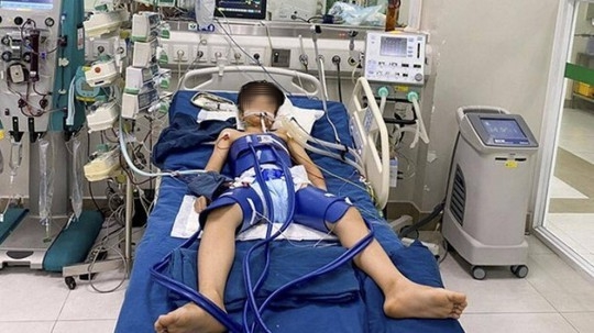 Bị qu&aacute; b&oacute;ng đ&aacute; tr&uacute;ng ngực, b&eacute; trai ngừng tuần ho&agrave;n gần 1 giờ - Ảnh 1.