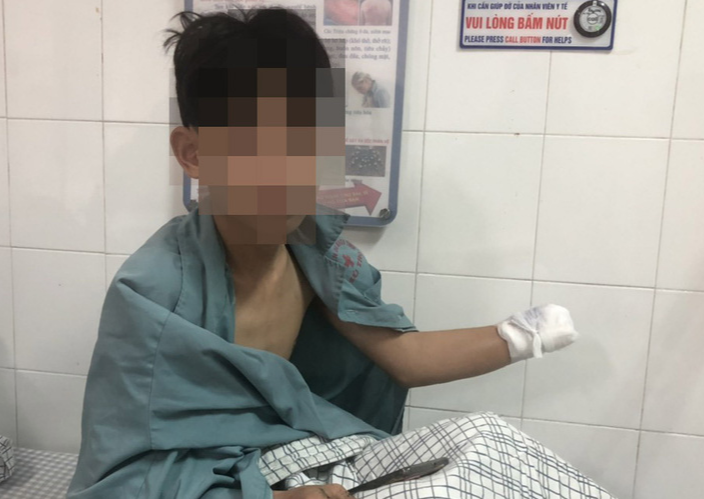 Tai nạn nghiêm trọng do pháo nổ