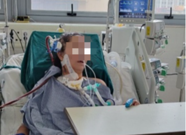 Lạm dụng corticoid tự điều trị cúm, nữ bệnh nhân 37 tuổi suy đa tạng