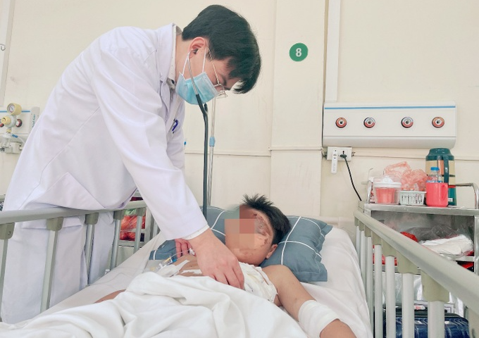 Pháo tự chế phát nổ khiến thiếu niên 14 tuổi bỏng mặt, 2 tay và chân, nghi tổn thương tim