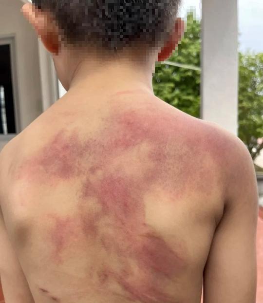 Tạm giữ cha ruột đánh dã man con trai