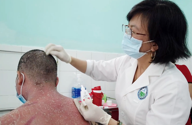 Người bệnh vảy nến bị ngứa phải làm sao?
