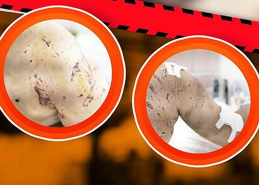 Bé gái 7 tuổi bị 4 con chó lao vào cắn, để lại hàng trăm vết thương