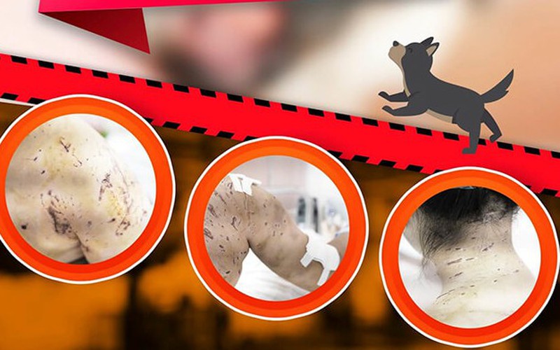 B&eacute; g&aacute;i 7 tuổi bị 4 con ch&oacute; lao v&agrave;o cắn - Ảnh 1.