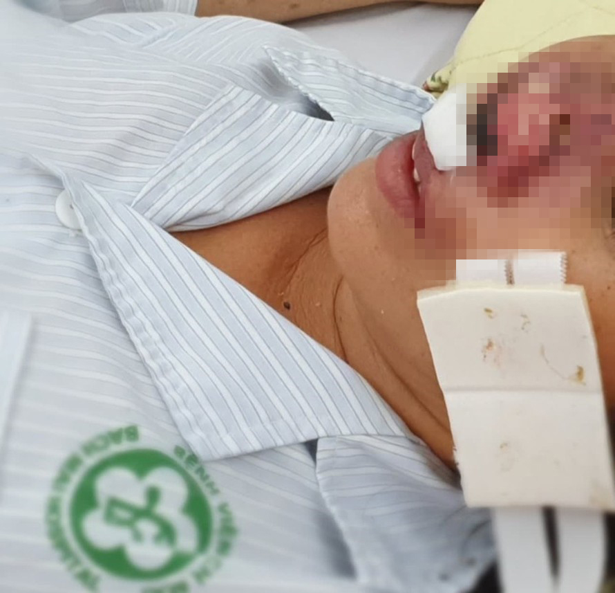 Sự thật khó ngờ về vi khuẩn "ăn thịt người"- Ảnh 10.